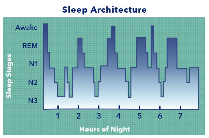 什么是睡眠睡眠架构
